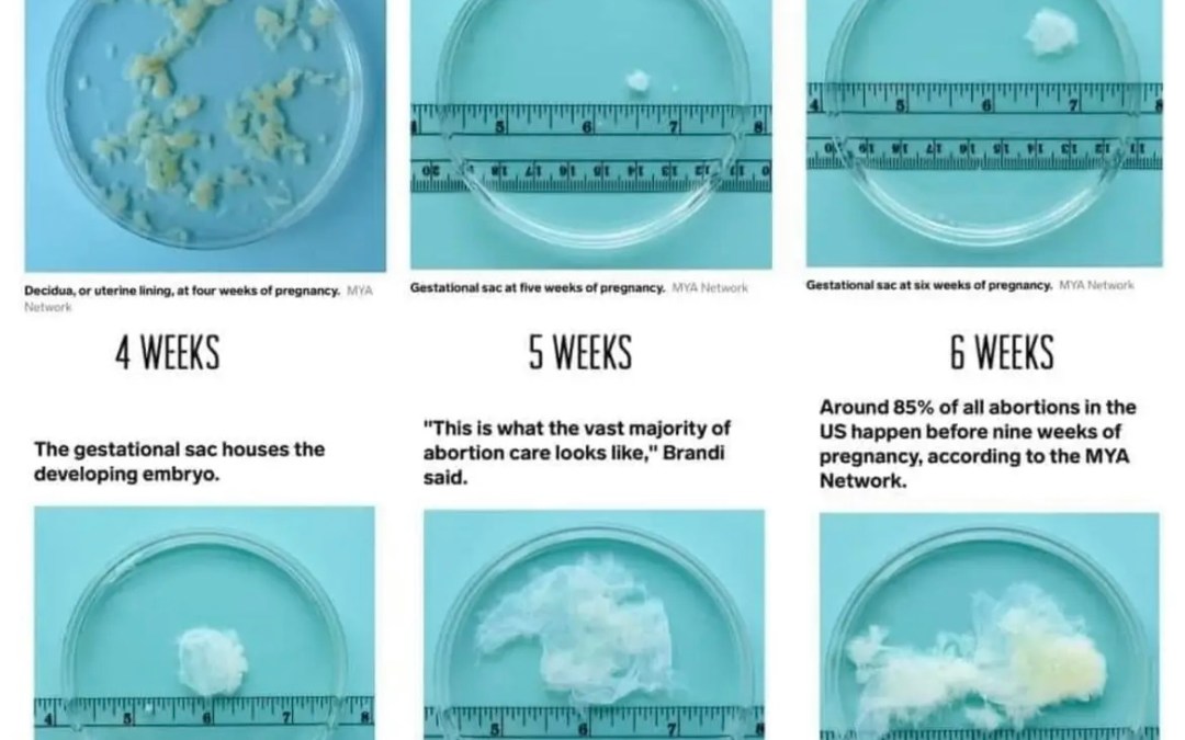 A Long History of Contraception…